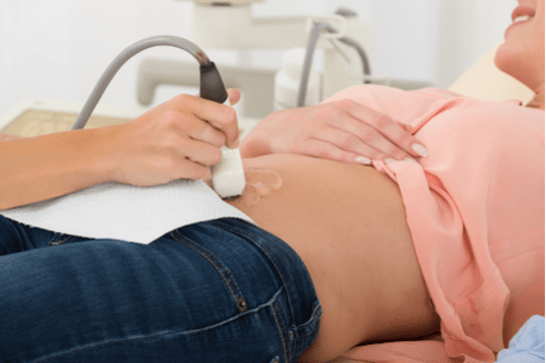 I Think I'm Pregnant: How Soon Should I See A Doctor? scan